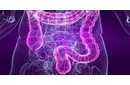 Bağırsak İltihabı Belirtileri ve Tedavisi