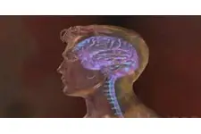 Beyin Zarı İltihabı Belirtileri ve Tedavisi