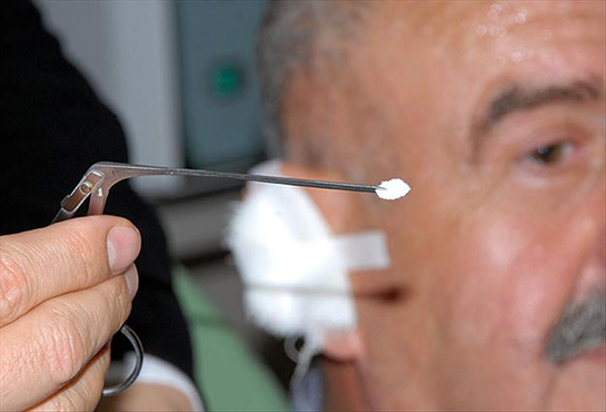 Kulak Zarı İltihabı Belirtileri ve Tedavisi